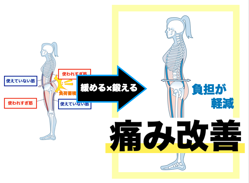 姿勢改善で痛みを防ぐ